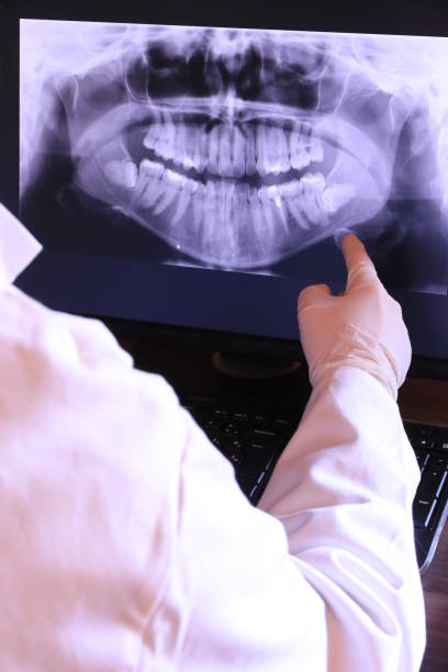 Best Emergency Treatment for Dental Infections or Abscesses in Cleburne, TX